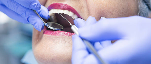 Best Emergency Wisdom Tooth Extraction in Mifflinburg, PA